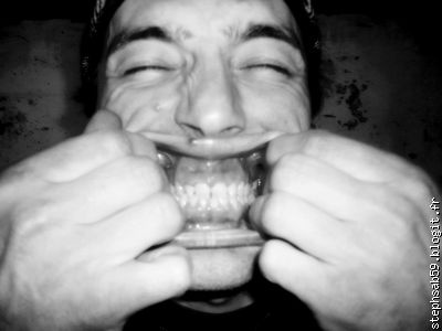 La dentition de BipBip  comme vous ne l'avez jamais vue !
